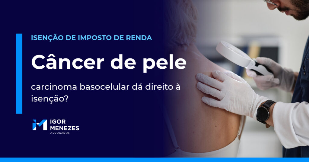 Carcinoma basocelular dá direito à isenção do Imposto de Renda? Guia para aposentados e pensionistas